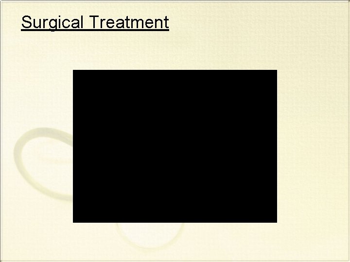 Surgical Treatment 