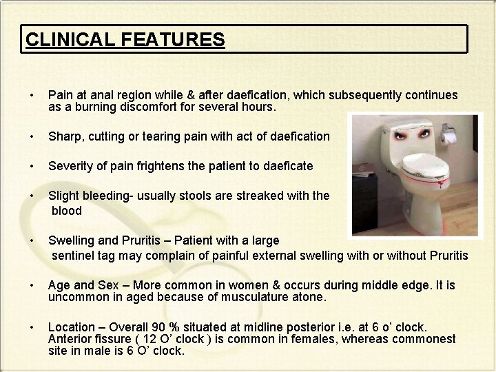 CLINICAL FEATURES • Pain at anal region while & after daefication, which subsequently continues