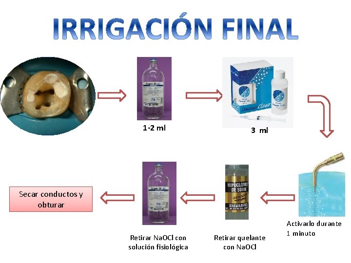 1 -2 ml 3 ml Secar conductos y obturar Retirar Na. OCl con 1 -2 ml 3 ml Secar conductos y obturar Retirar Na. OCl con