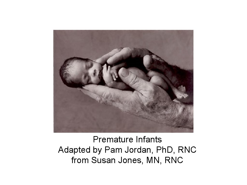 Premature Infants Adapted by Pam Jordan, Ph. D, RNC from Susan Jones, MN, RNC