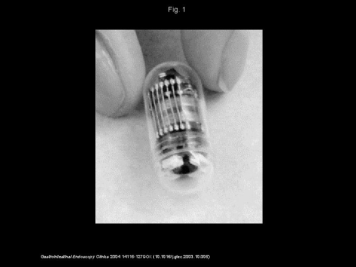 Fig. 1 Gastrointestinal Endoscopy Clinics 2004 14115 -127 DOI: (10. 1016/j. giec. 2003. 10.