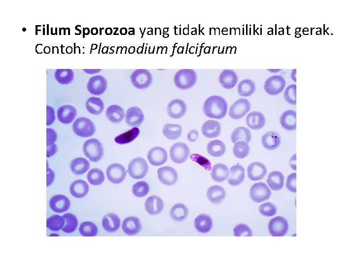  • Filum Sporozoa yang tidak memiliki alat gerak. Contoh: Plasmodium falcifarum 