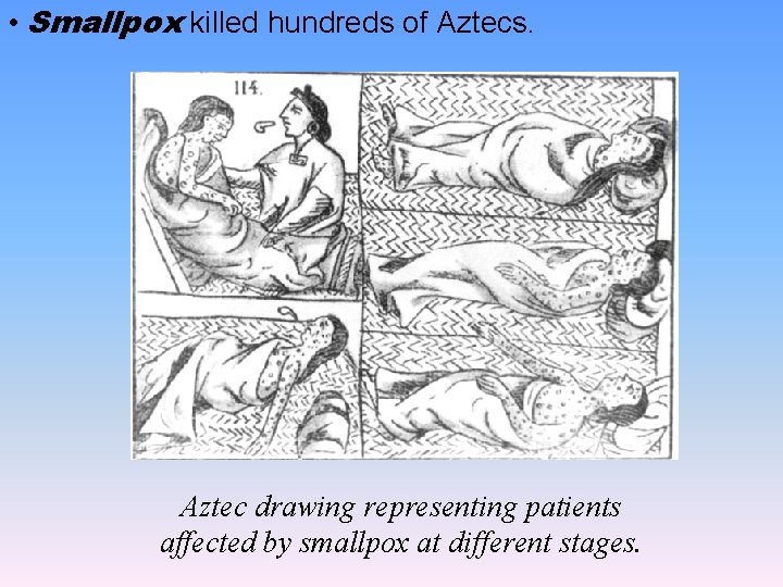  • Smallpox killed hundreds of Aztecs. Aztec drawing representing patients affected by smallpox