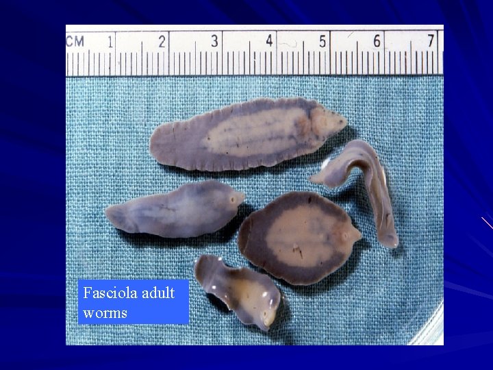 Fasciola adult worms 