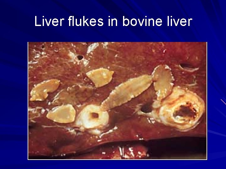 Liver flukes in bovine liver 