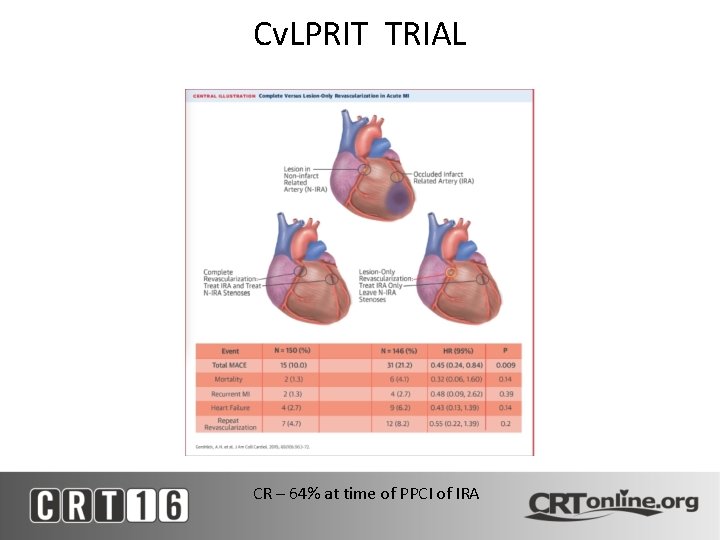 Cv. LPRIT TRIAL CR – 64% at time of PPCI of IRA 