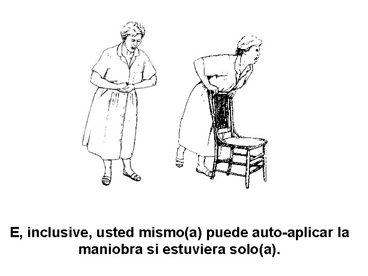 E, inclusive, usted mismo(a) puede auto-aplicar la maniobra si estuviera solo(a). 