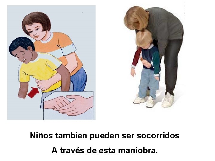 Niños tambien pueden ser socorridos A través de esta maniobra. 