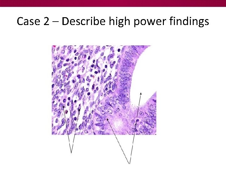 Case 2 – Describe high power findings 
