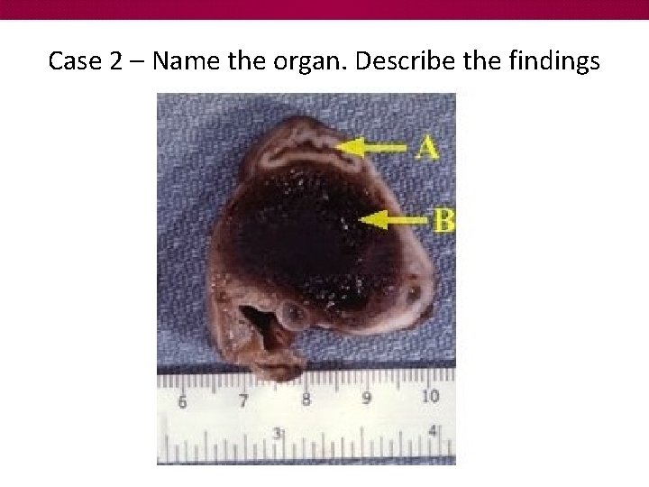 Case 2 – Name the organ. Describe the findings 