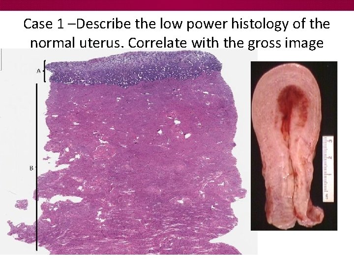 Case 1 –Describe the low power histology of the normal uterus. Correlate with the