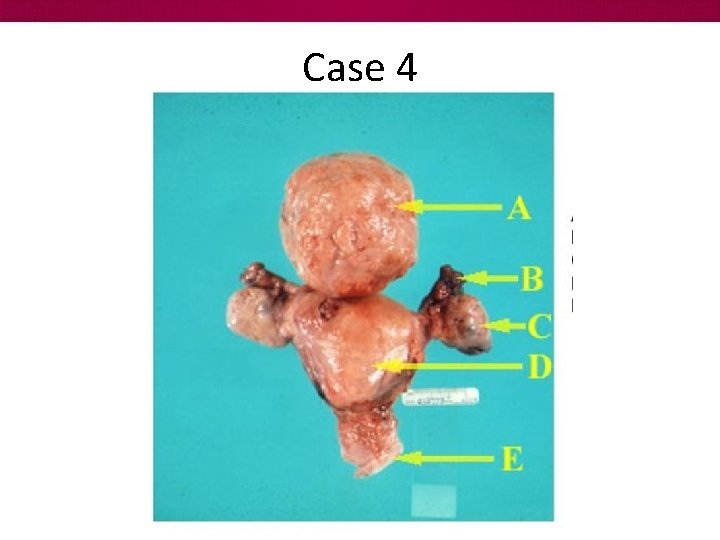 Case 4 