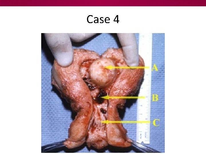 Case 4 