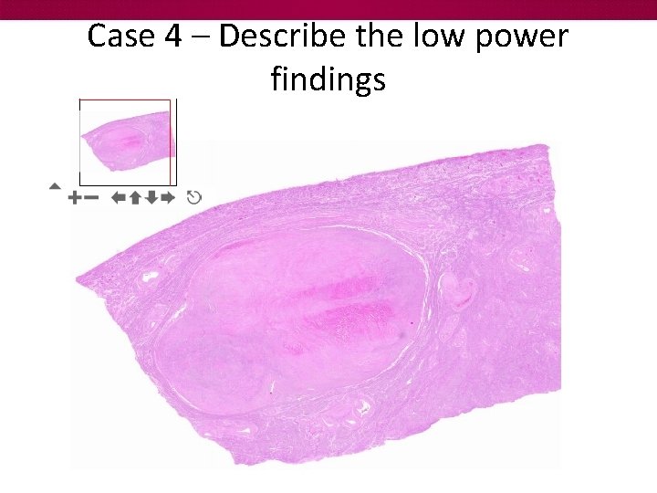 Case 4 – Describe the low power findings 
