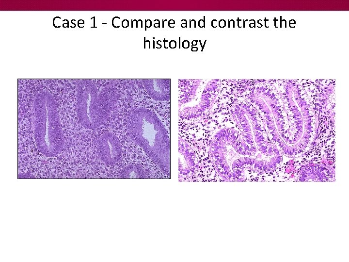 Case 1 - Compare and contrast the histology 