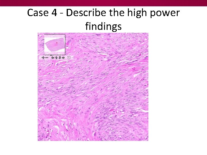 Case 4 - Describe the high power findings 
