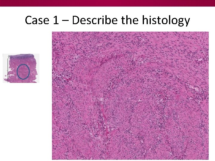 Case 1 – Describe the histology 
