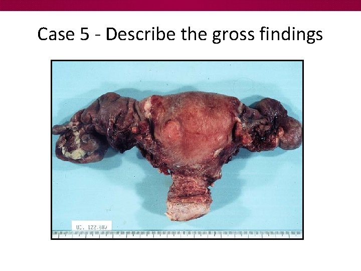 Case 5 - Describe the gross findings 