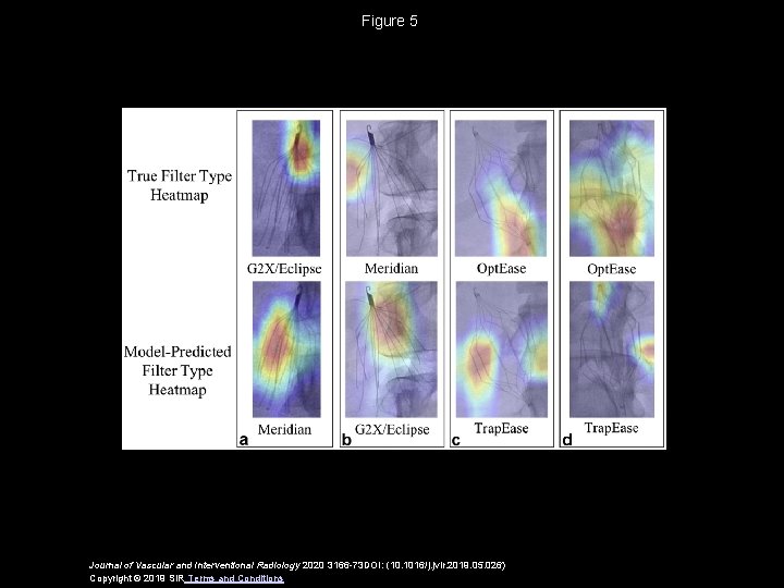 Figure 5 Journal of Vascular and Interventional Radiology 2020 3166 -73 DOI: (10. 1016/j.