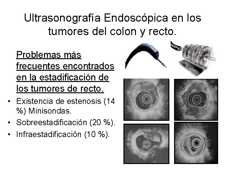 Ultrasonografía Endoscópica en los tumores del colon y recto. Problemas más frecuentes encontrados en