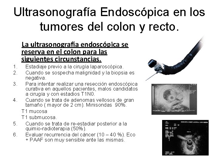 Ultrasonografía Endoscópica en los tumores del colon y recto. La ultrasonografía endoscópica se reserva