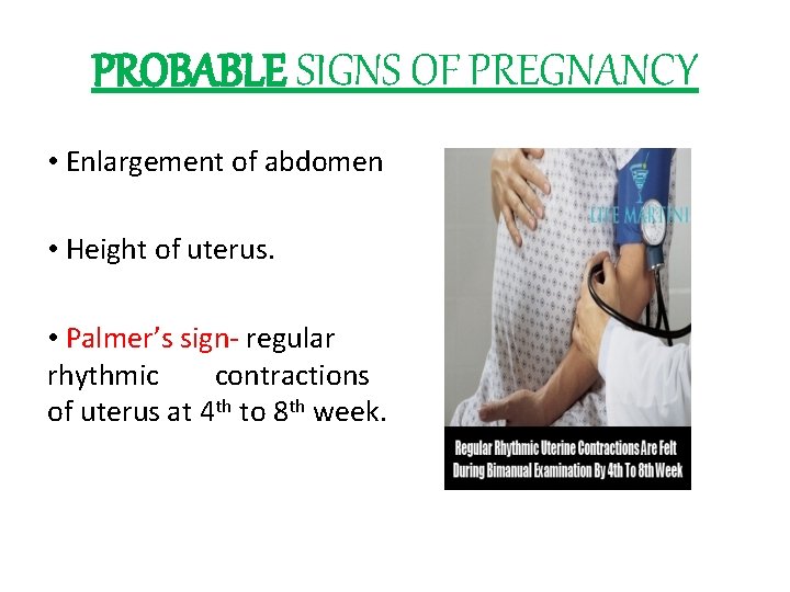 PROBABLE SIGNS OF PREGNANCY • Enlargement of abdomen • Height of uterus. • Palmer’s