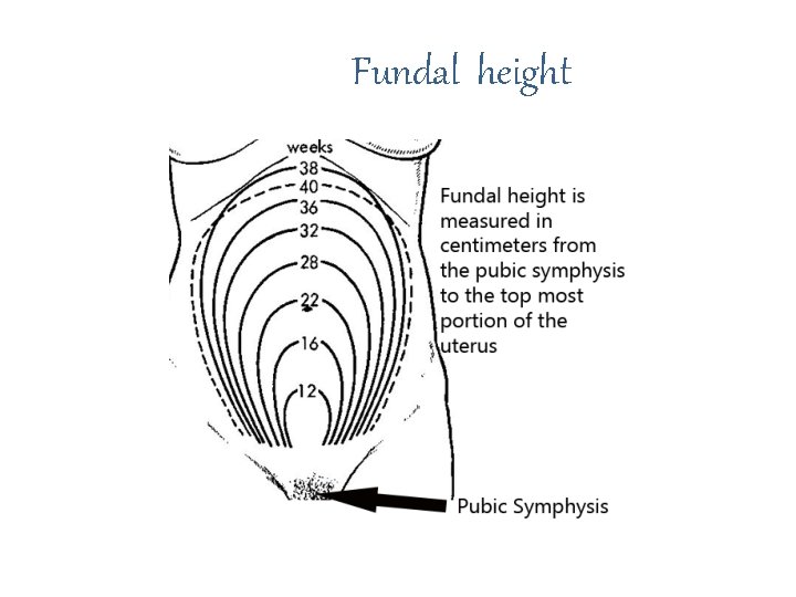 Fundal height 