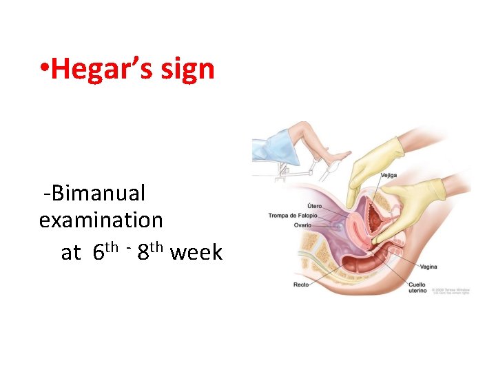  • Hegar’s sign -Bimanual examination at 6 th - 8 th week 