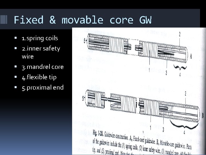 Fixed & movable core GW 1. spring coils 2. inner safety wire 3. mandrel Fixed & movable core GW 1. spring coils 2. inner safety wire 3. mandrel