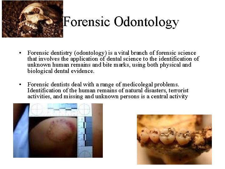 Forensic Odontology • Forensic dentistry (odontology) is a vital branch of forensic science