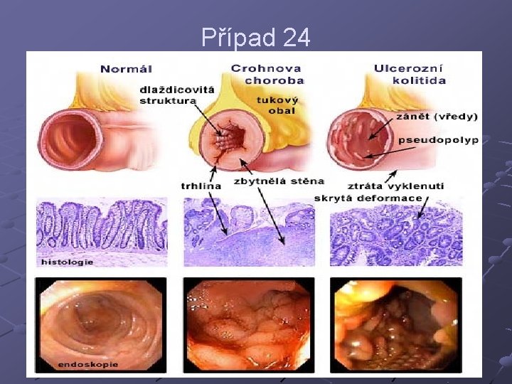 Případ 24 