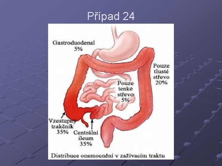 Případ 24 