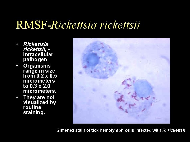 RMSF-Rickettsia rickettsii • Rickettsia rickettsii, - intracellular pathogen • Organisms range in size from