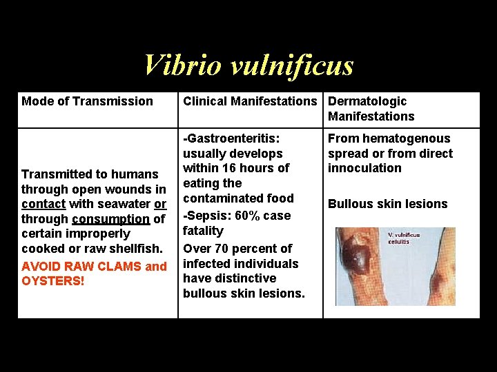 Vibrio vulnificus Mode of Transmission Transmitted to humans through open wounds in contact with