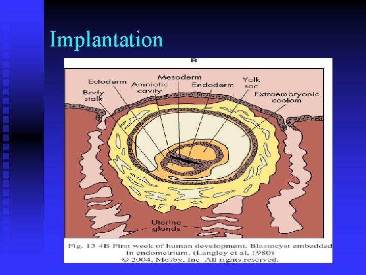 Implantation Implantation