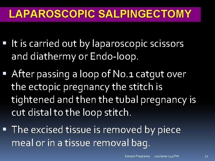 LAPAROSCOPIC SALPINGECTOMY It is carried out by laparoscopic scissors and diathermy or Endo-loop. After
