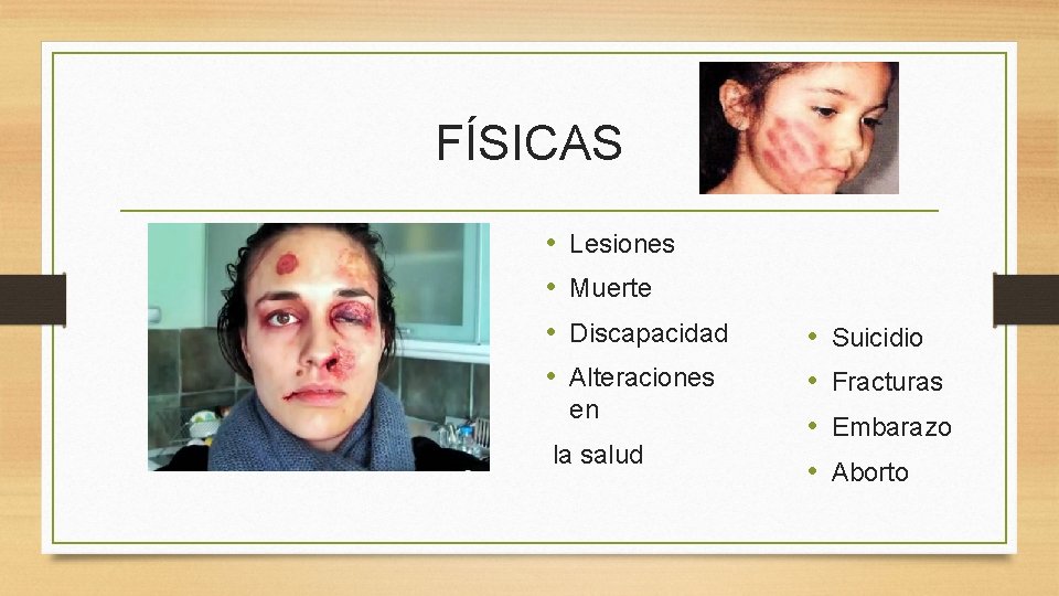 FÍSICAS • • Lesiones Muerte Discapacidad Alteraciones en la salud • • Suicidio Fracturas