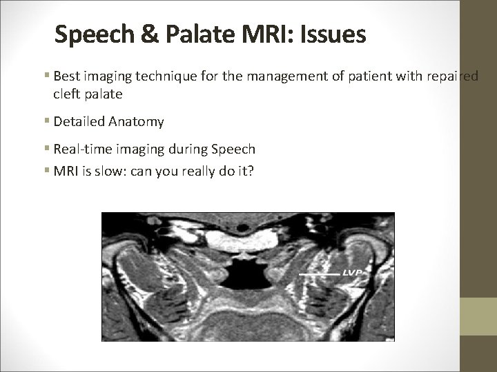 Speech & Palate MRI: Issues § Best imaging technique for the management of patient