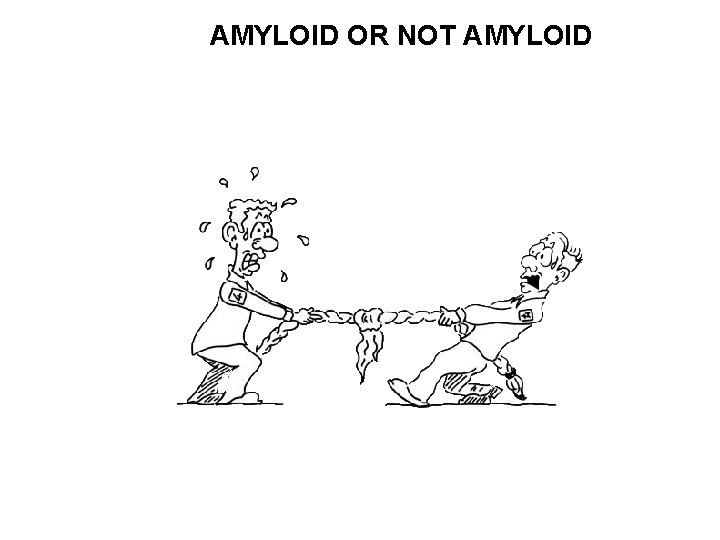 AMYLOID OR NOT AMYLOID 