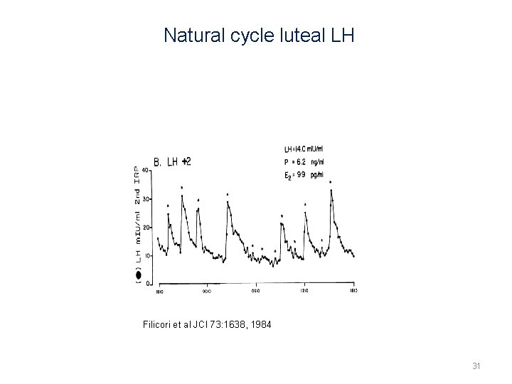 Natural cycle luteal LH Filicori et al JCI 73: 1638, 1984 31 