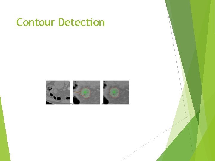 Contour Detection 