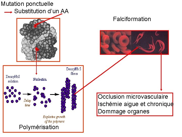 Mutation ponctuelle Substitution d’un AA Falciformation Occlusion microvasculaire Ischémie aigue et chronique Dommage organes