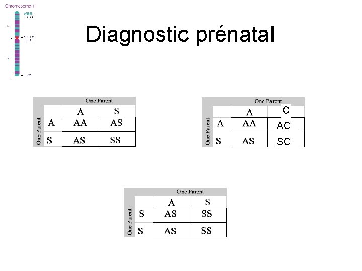 Diagnostic prénatal C AC SC 