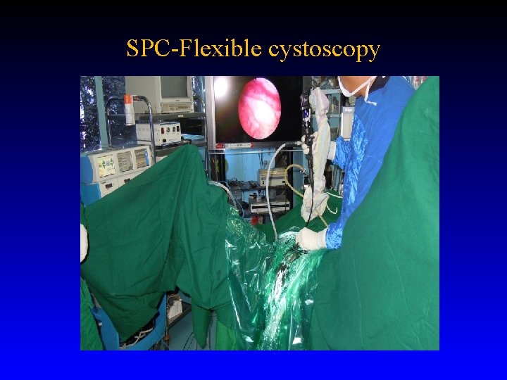 SPC-Flexible cystoscopy 