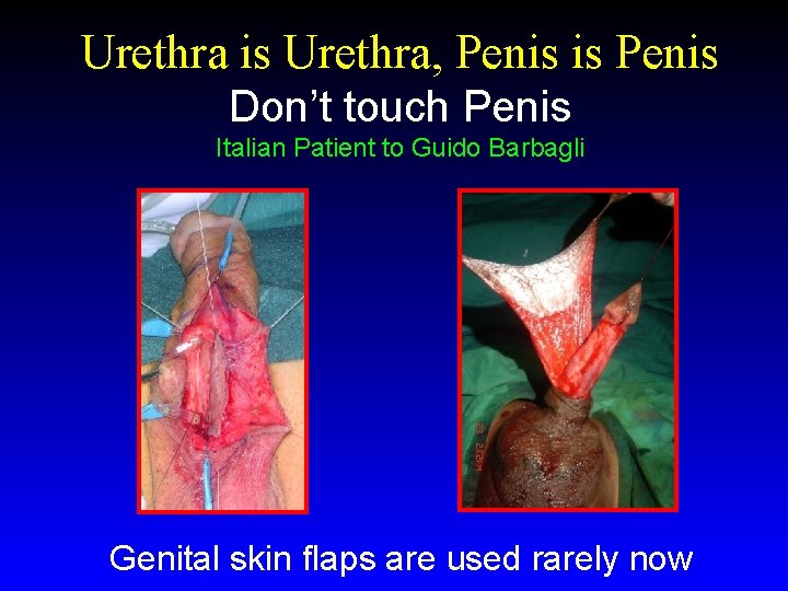 Urethra is Urethra, Penis is Penis Don’t touch Penis Italian Patient to Guido Barbagli