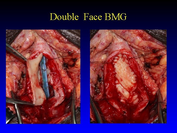 Double Face BMG Double Face BMG