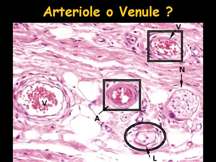 Arteriole o Venule ? 