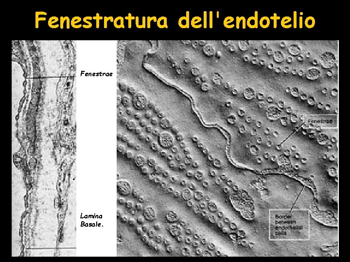 Fenestratura dell'endotelio Fenestrae Lamina Basale. 