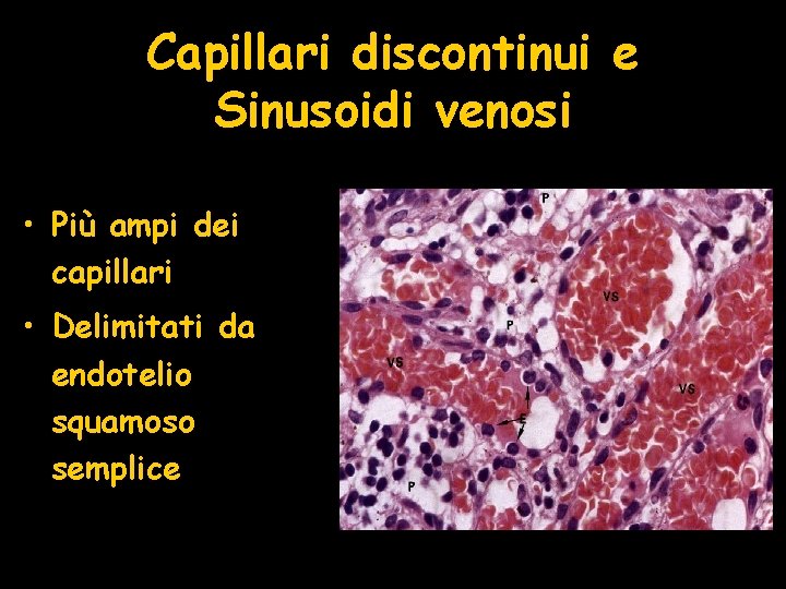 Capillari discontinui e Sinusoidi venosi • Più ampi dei capillari • Delimitati da endotelio