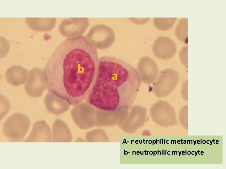 b a A- neutrophilic metamyelocyte b- neutrophilic myelocyte 